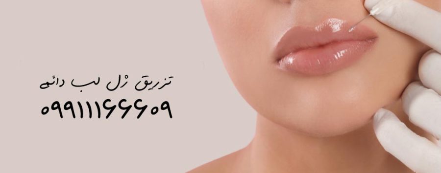 تزریق ژل لب دائمی