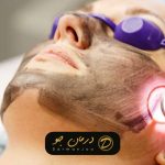 لیزر روشن سازی