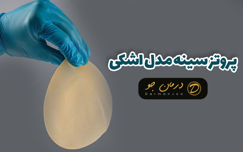 پروتز سينه مدل اشکی 1 پروتز سينه مدل اشکی