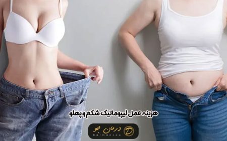 هزینه عمل لیپوماتیک شکم و پهلو 1404