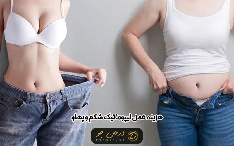 هزینه عمل لیپوماتیک شکم و پهلو 1404