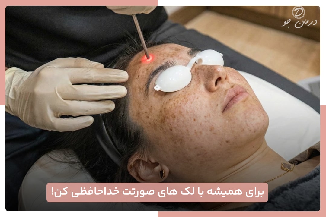 درمان لک صورت