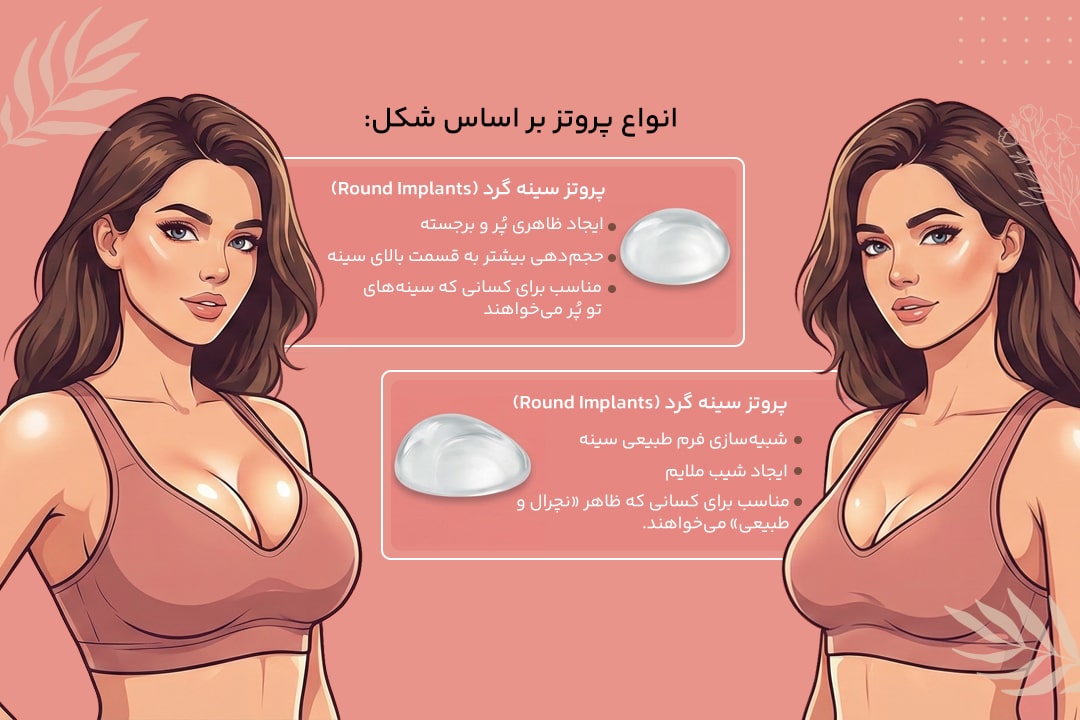 انواع پروتز سینه