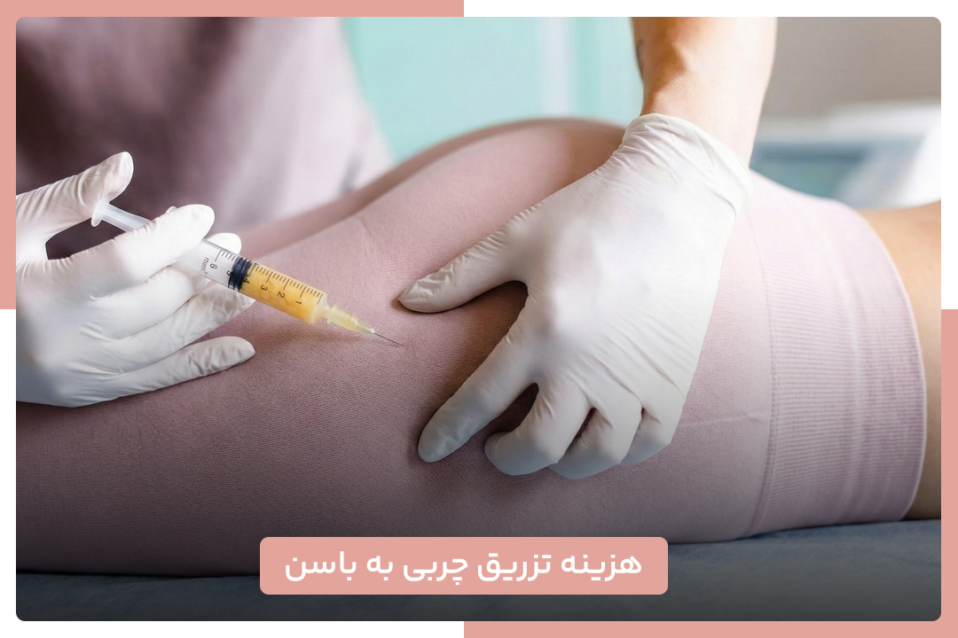 هزینه تزریق چربی به باسن