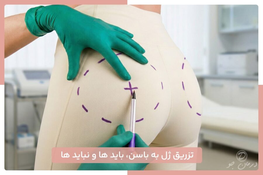 تزریق ژل به باسن