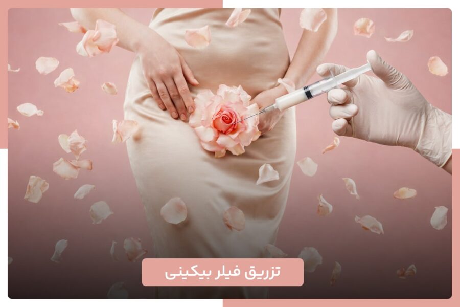 فیلر بیکینی