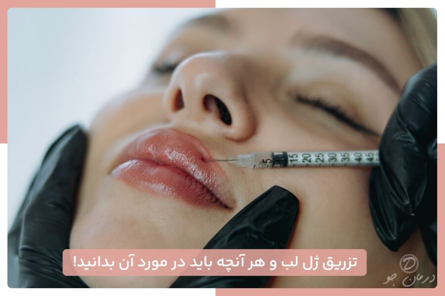 تزریق ژل لب