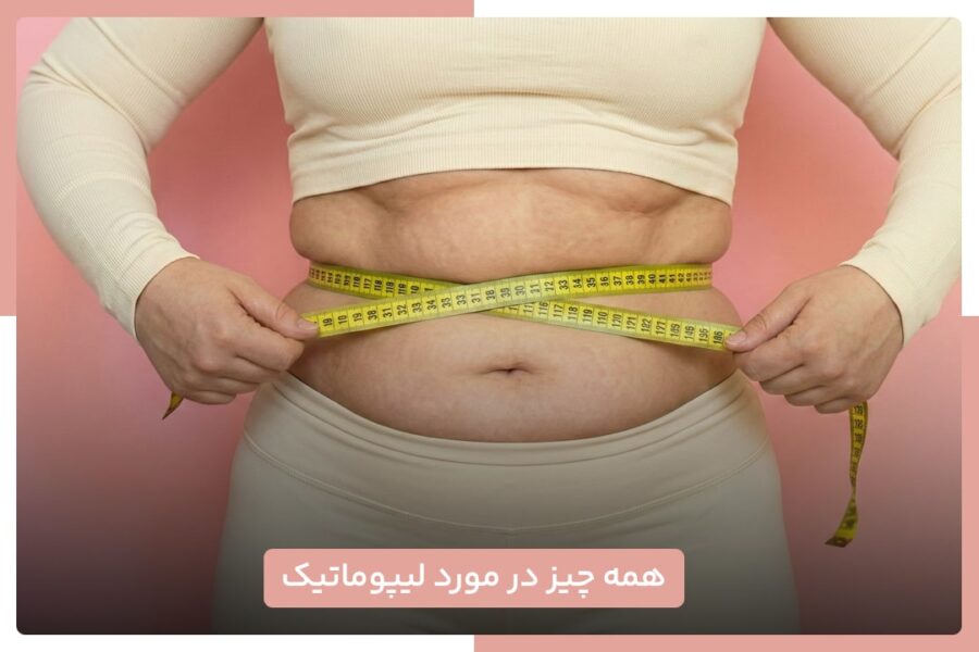 لیپوماتیک 1 لیپوماتیک