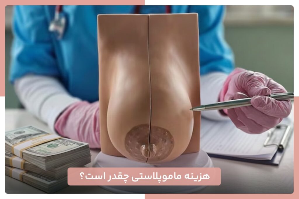 هزینه ماموپلاستی