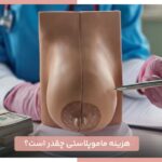 هزینه ماموپلاستی