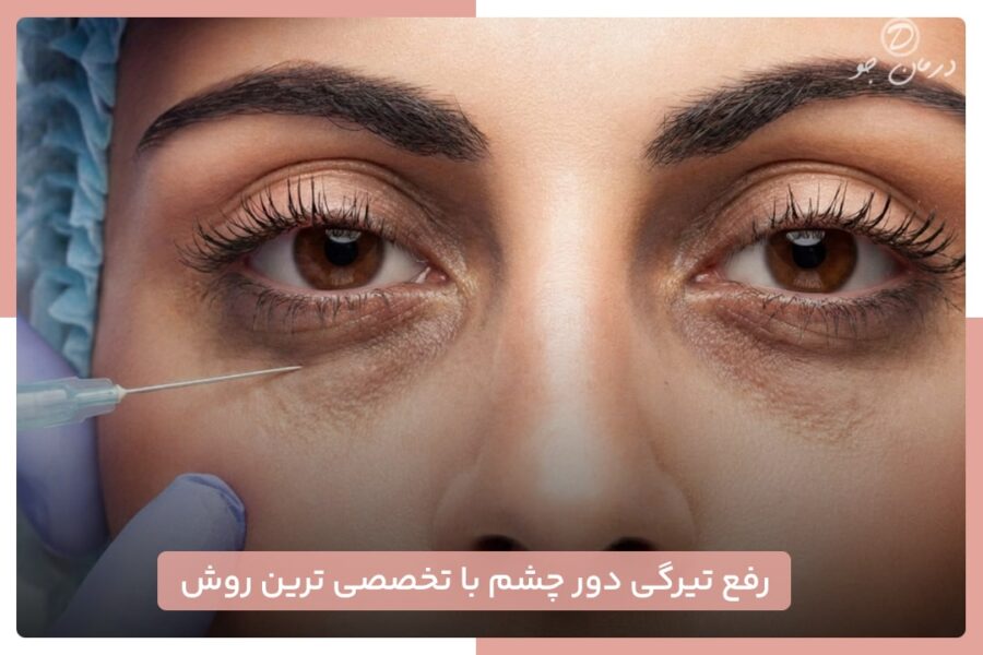 رفع تیرگی دور چشم