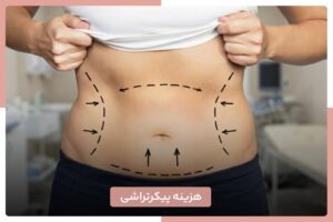 هزینه پیکرتراشی