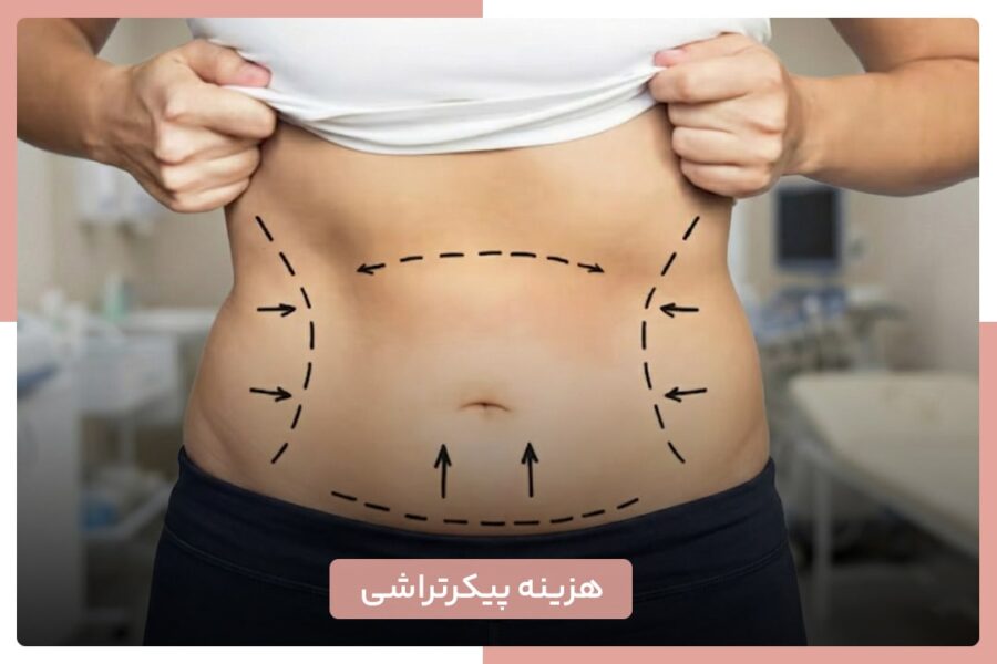 هزینه پیکرتراشی