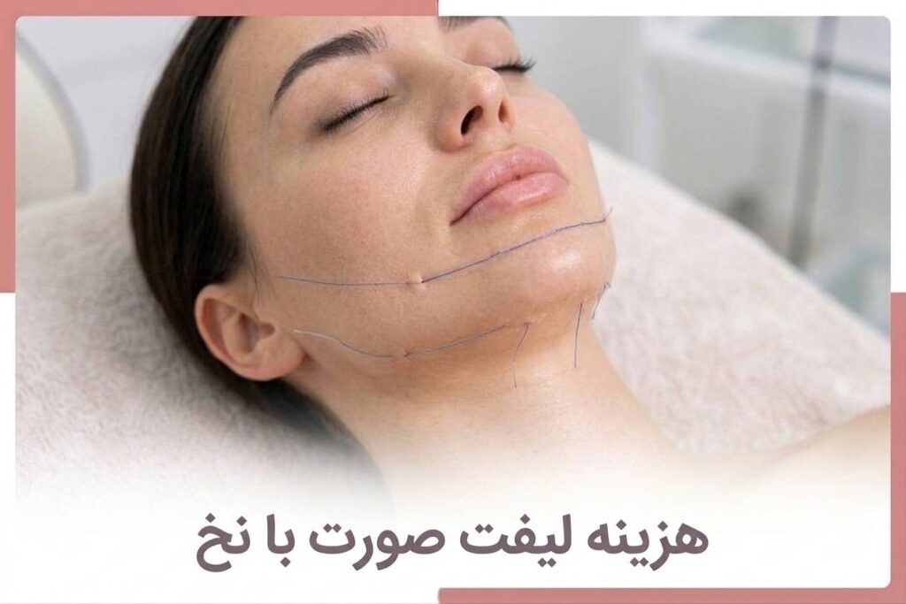 Cost of thread facelift