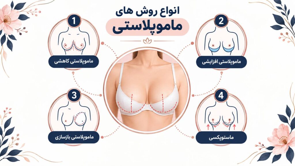 ماموپلاستی 1 روش های ماموپلاستی